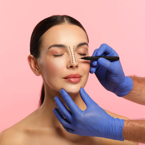 rhinoplasty in london