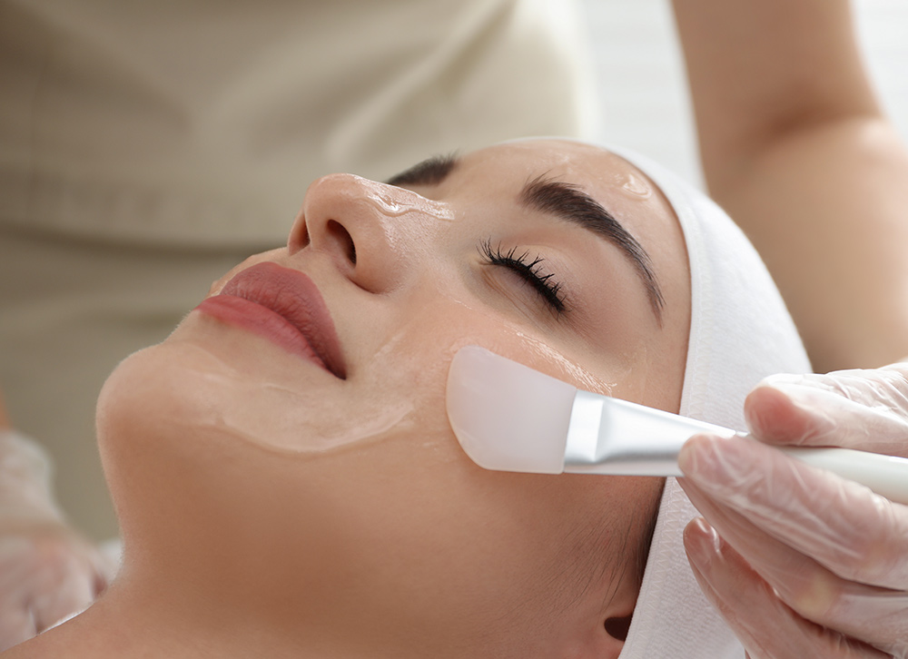 TCA skin peel TCA skin peel London TCA chemical peel Trichloroacetic acid peel Medium depth chemical peel Chemical peel treatment