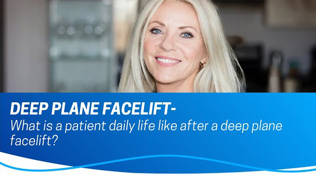 What Daily Life Can Feel Like After a Deep Plane Facelift