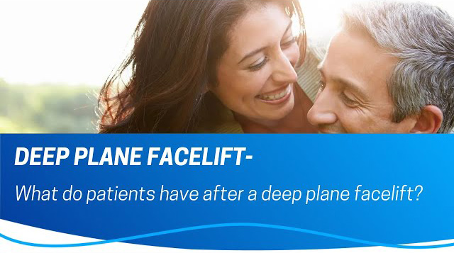 What Results Can You Expect After a Deep Plane Facelift