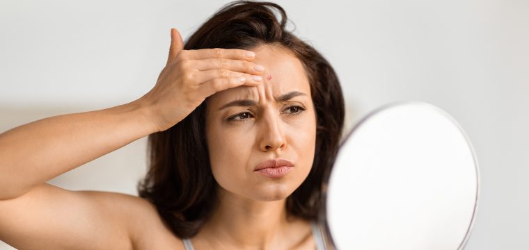 types of wrinkles different types of wrinkles wrinkle types what causes wrinkles