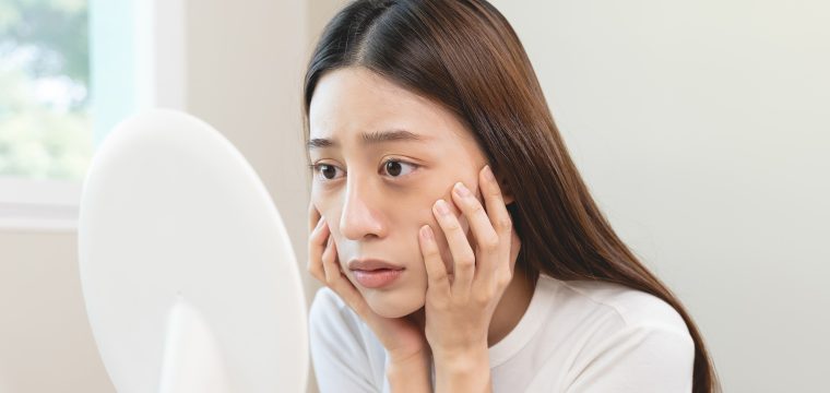 how to get rid of eye bags, under eye bags, eye bags, lower blepharoplasty